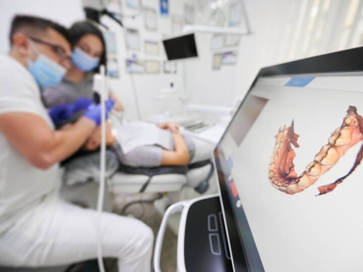 Le scan 3D et ses divers champs d&rsquo;application