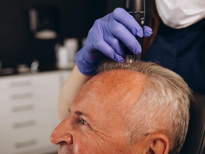 France ou Turquie : quel pays choisir pour sa greffe de cheveux ?